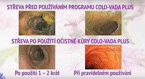 Klikněte pro zvětšení obrázku